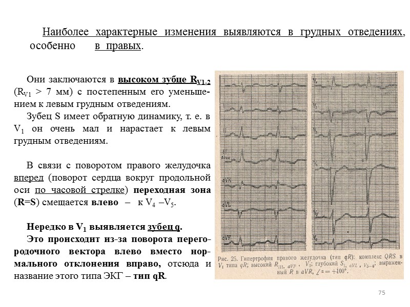 75 Они заключаются 75 Они заключаются